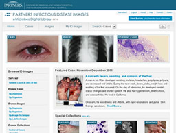 Partners Infectious Disease Images